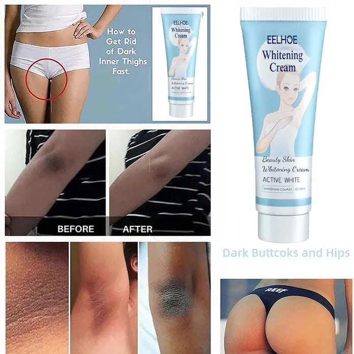 🔥SUMMER HOT SALE🔥WOMEN WHITENING CREAM