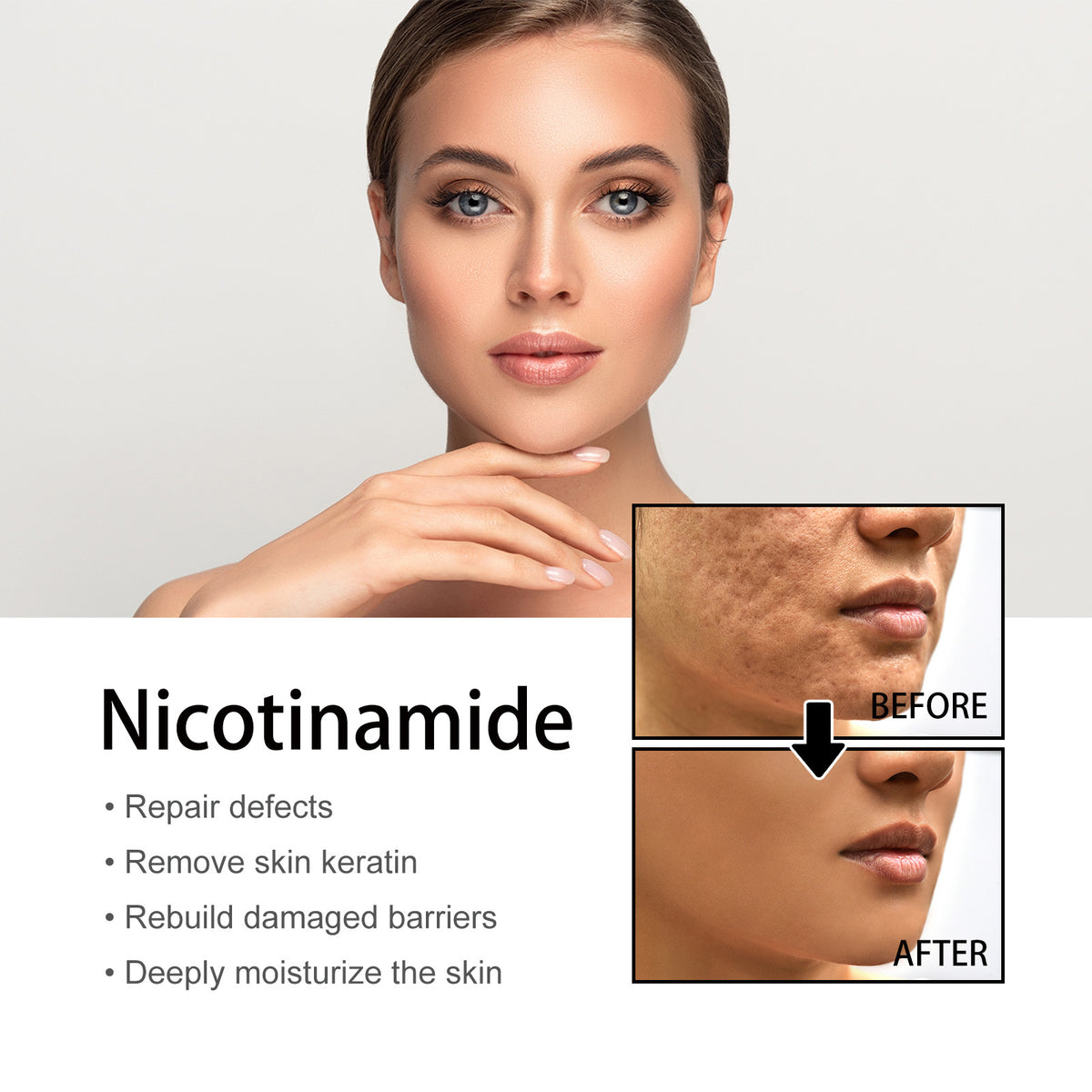 🔥Last Day Promotion 70% OFF-Niacinamide Facial Essence💖