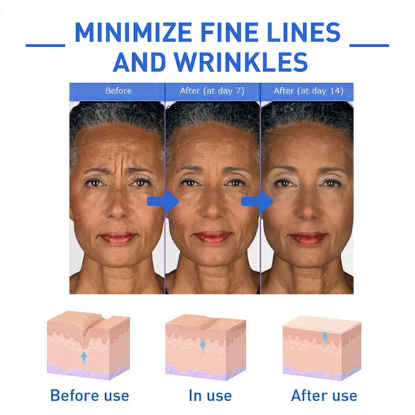 🎉Buy 1 Get 1 Free🎁 - Botox Face Serum