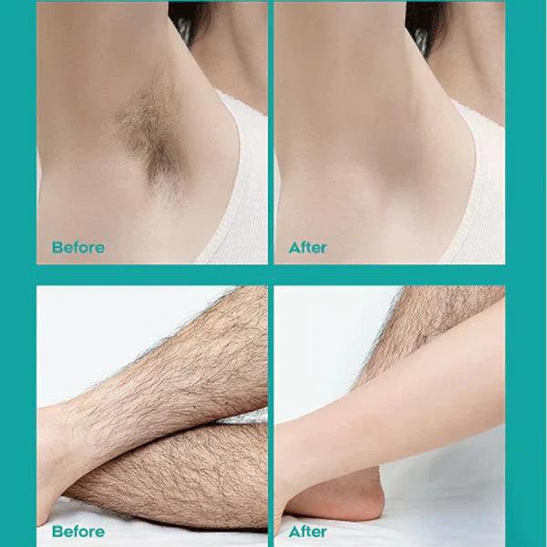 ❤️Limited Sale 50% OFF🔥Painless Full Body Hair Removal Cream for Men & Women– Skin-friendly for all areas🌿