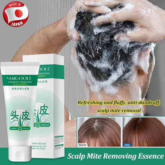 Anti-Dandruff Artemisia Conditioner-【BUY 2 GET 1 FREE】