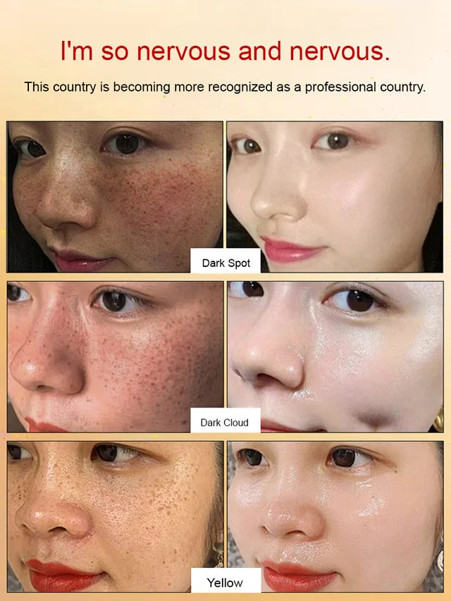Whitening and anti-freckle essence