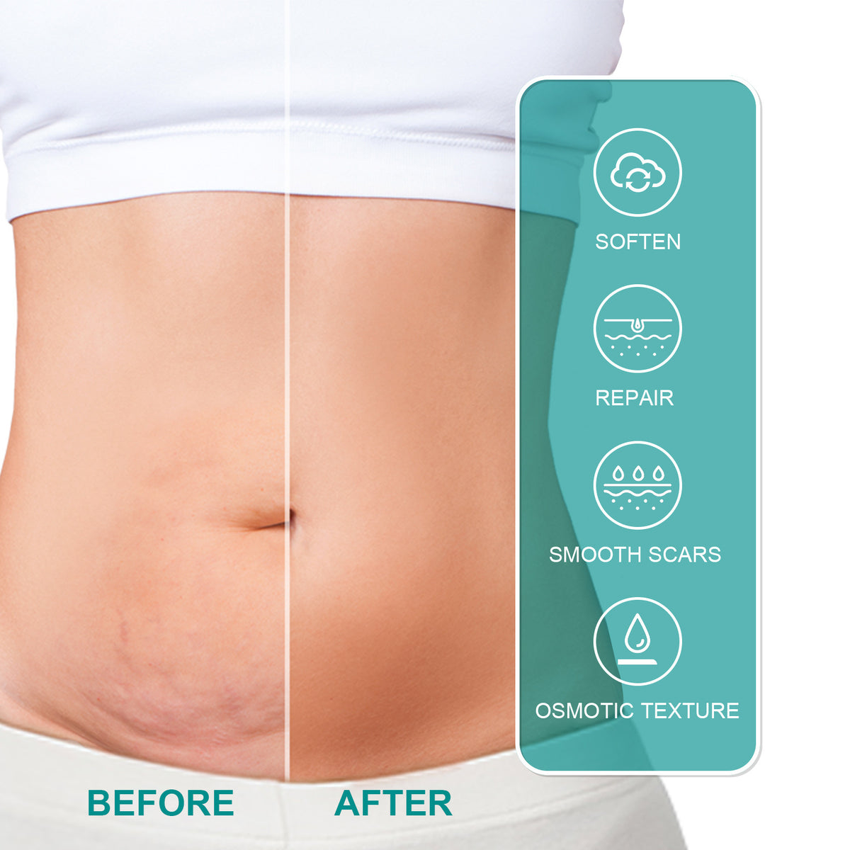 SCAR REMOVAL SPRAY