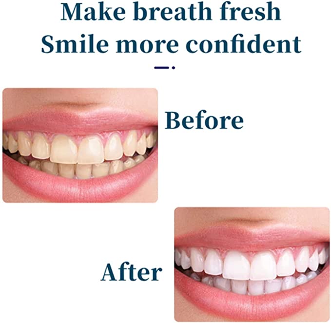 Brightening & Stain Removing Probiotic Toothpaste