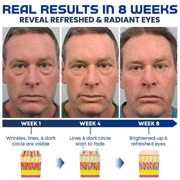 East Moon Awaken Peptide Depuffing Eye Gel