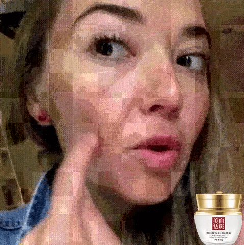 Hot sale Freckle removal and whitening cream