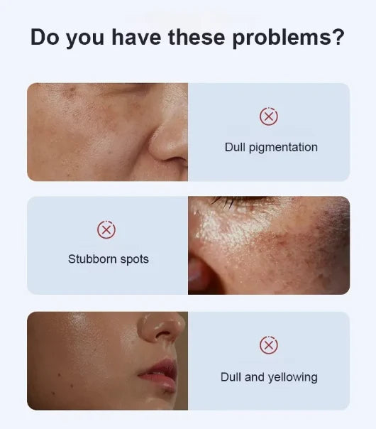 Deep Whitening & Spot Correcting Cream