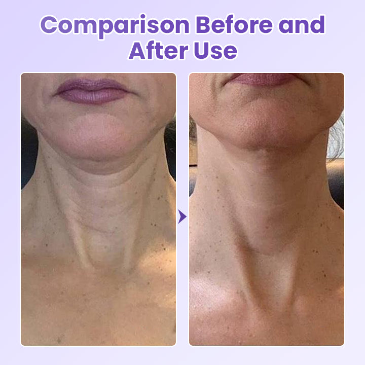 NeckYouth Peptide Anti-Wrinkle Patch
