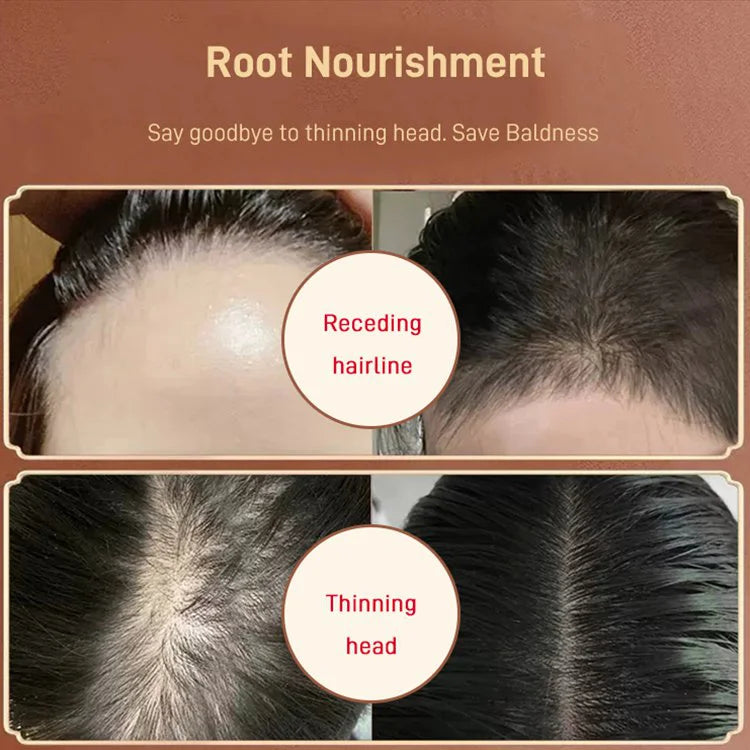 Anti-hair loss ginger shampoo