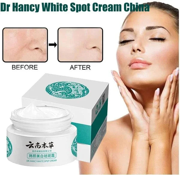 🔥BUY 1 GET 1 (2PCS)🔥 - 🌿Yunnan Herbal Whitening and Freckle-Removing Cream
