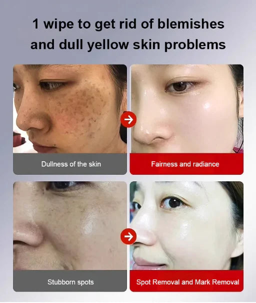 Deep Whitening & Spot Correcting Cream