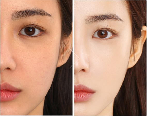Butterfly Air cushion BB cream