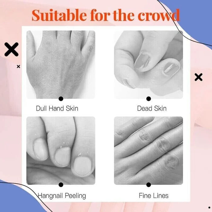 Hot Sale Hyaluronic Acid Hand Care Essence( 🔥Buy 1 Get1 Free🔥 )