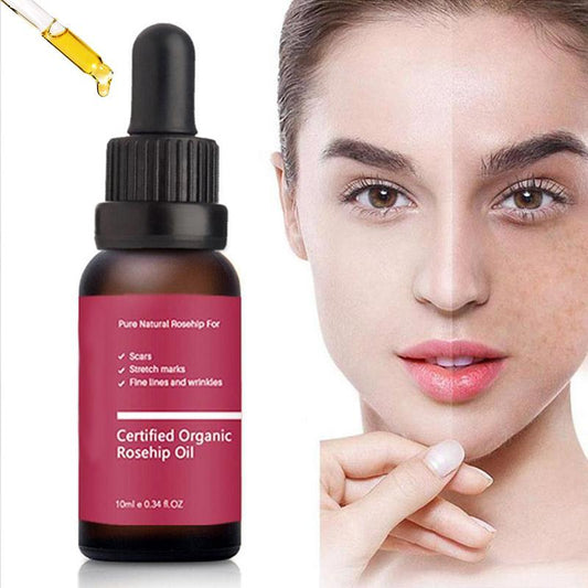 Certified Organic Rosehip Oil